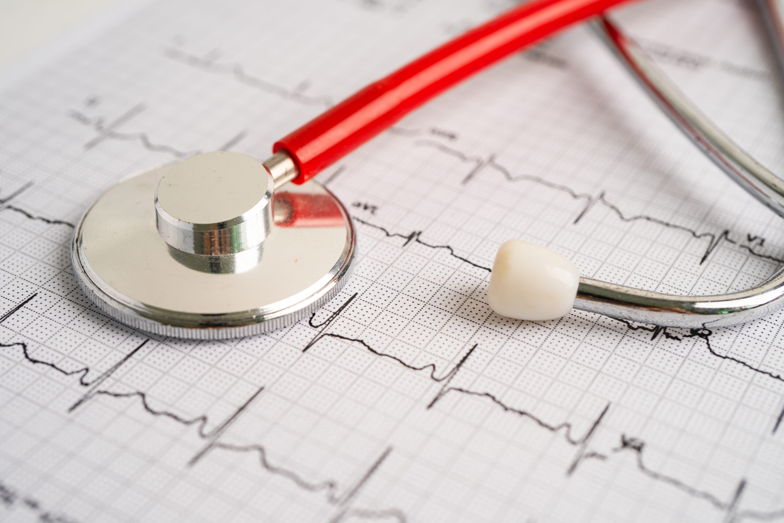 Red stethoscope on electrocardiogram (ECG) chart