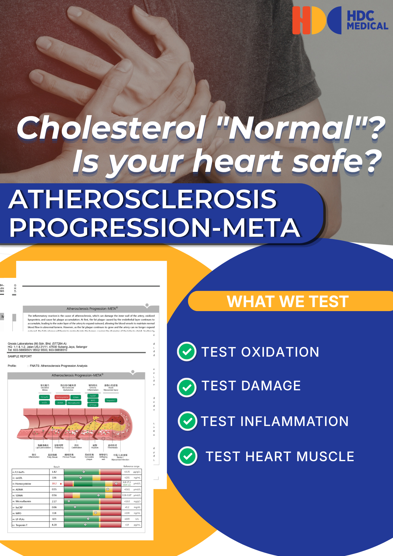 Atherosclerosis test: Cholesterol, heart health assessment.
