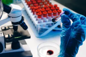 Hands of a laboratory worker performing a kidney function blood test