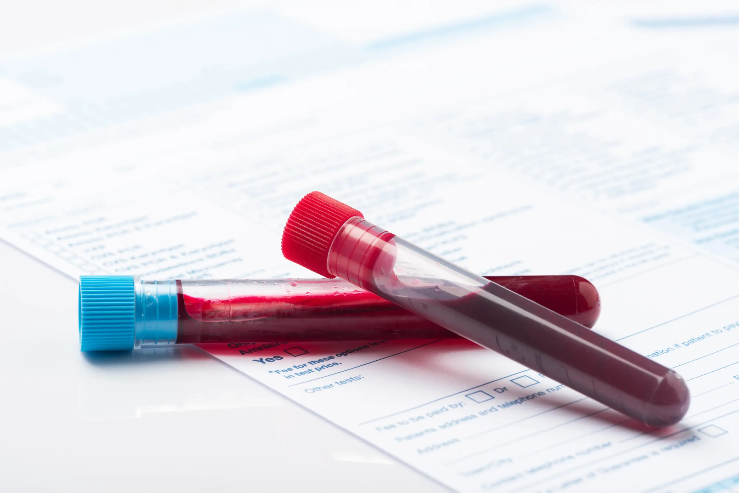 Laboratory technician processing patient blood samples for antibody testing