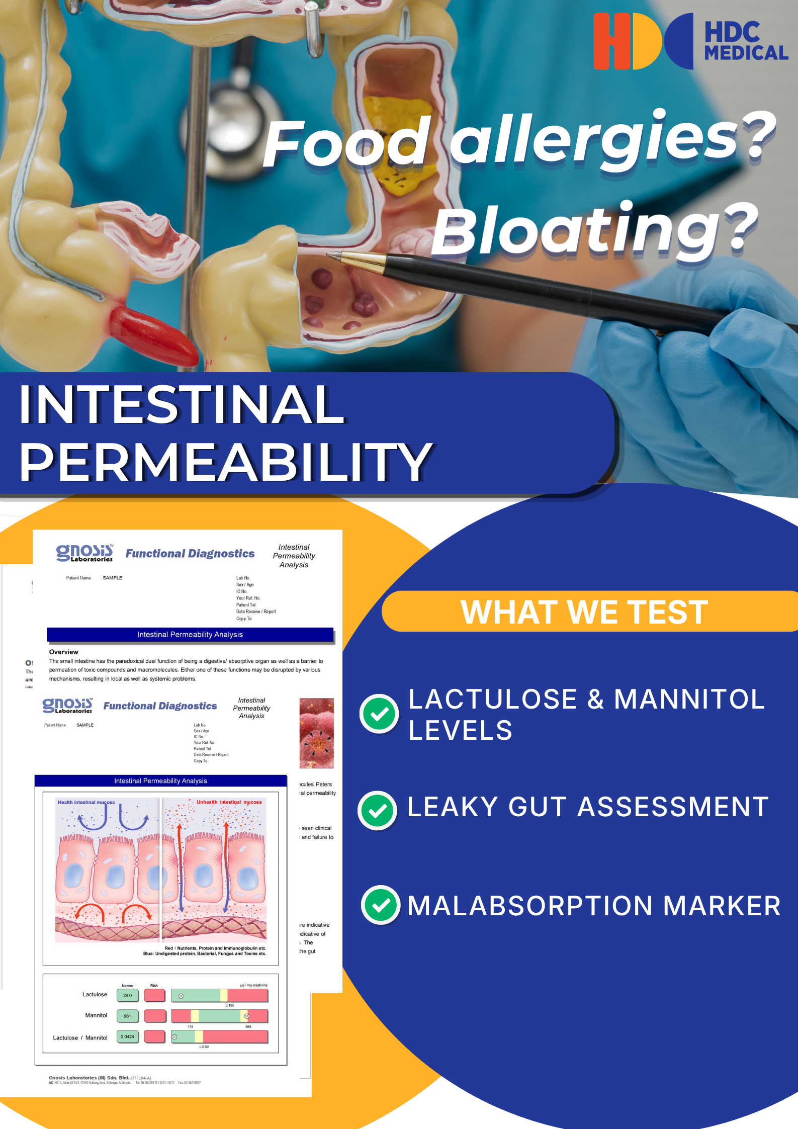 Intestinal permeability test for food allergies and bloating.