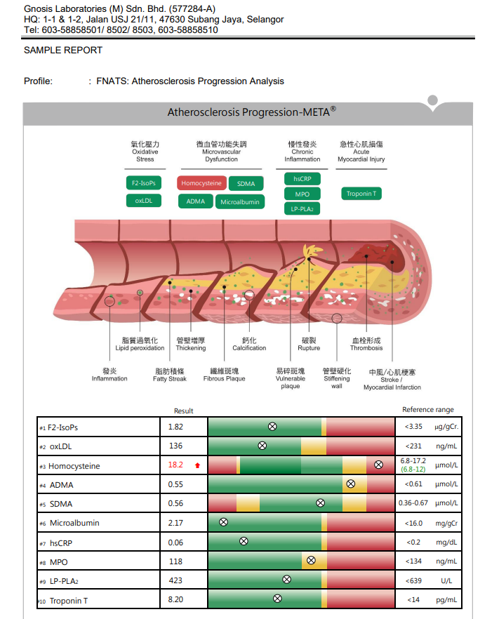 Atherosclerosis progression analysis report with test results.